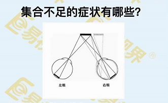 集合不足的癥狀有哪些？